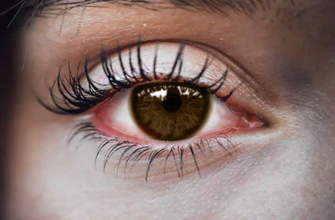 Hero_Article_PinkEye-Eye-compressor.jpg